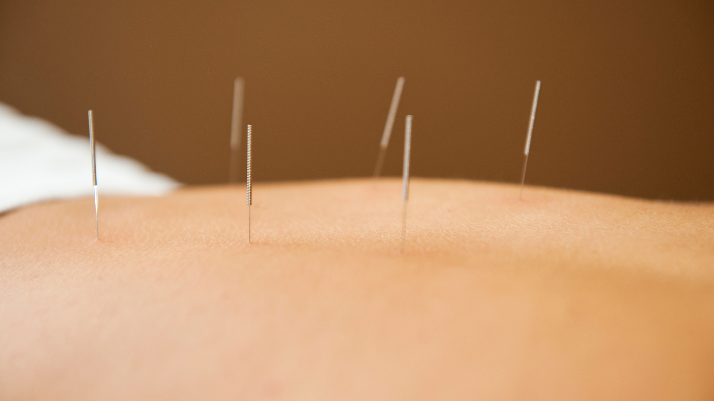 Body Mechanix Harpenden Harpenden Osteopath | Harpenden Physiotherapy | Harpenden Sports Massage