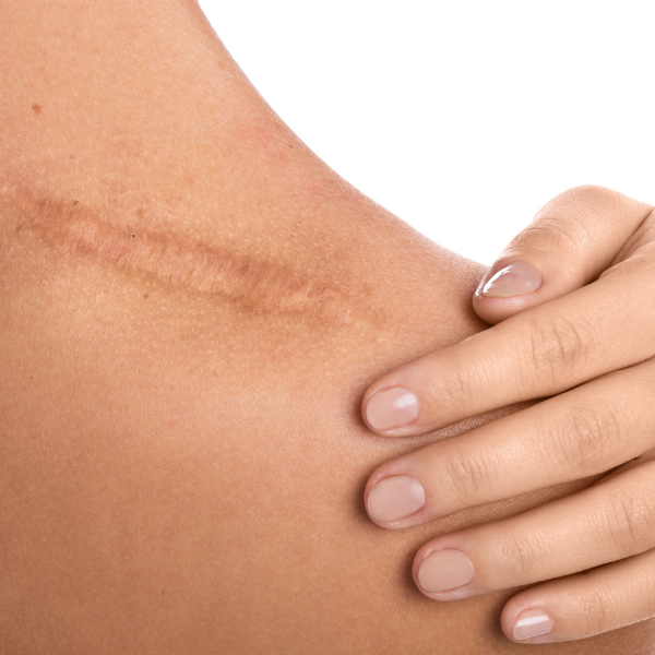 Body Mechanix Harpenden   Harpenden Osteopath | Harpenden Physiotherapy | Harpenden Sports Massage